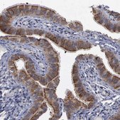 Anti-CRKL antibody produced in rabbit affinity isolated antibody, buffered aqueous glycerol solution