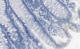 Anti-p-DNA-PKcs-Ser2056 Antibody, clone 1K3 ZooMAb&#174; Rabbit Monoclonal recombinant, expressed in HEK 293 cells