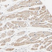Anti-TRIOBP antibody produced in rabbit Prestige Antibodies&#174; Powered by Atlas Antibodies, affinity isolated antibody, buffered aqueous glycerol solution