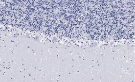 Anti-Parvalbumin Antibody, clone 4G3 , ZooMAb&#174; Rabbit Monoclonal recombinant, expressed in HEK 293 cells