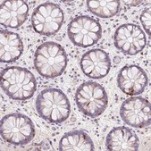 Anti-CD83 antibody produced in rabbit Prestige Antibodies&#174; Powered by Atlas Antibodies, affinity isolated antibody, buffered aqueous glycerol solution