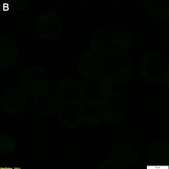 Anti-RSV type A Antibody, B Antibody, clone 133-1H ZooMAb&#174; Mouse Monoclonal recombinant, expressed in HEK 293 cells