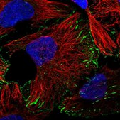 Anti-TRIM71 antibody produced in rabbit Prestige Antibodies&#174; Powered by Atlas Antibodies, affinity isolated antibody, buffered aqueous glycerol solution