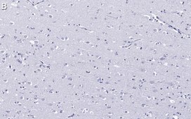 Anti-EEA1 Antibody, clone 1H18 ZooMAb&#174; Rabbit Monoclonal recombinant, expressed in HEK 293 cells