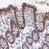 Anti-NQO1 antibody produced in rabbit Prestige Antibodies&#174; Powered by Atlas Antibodies, affinity isolated antibody, buffered aqueous glycerol solution