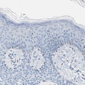 Anti-CA3 antibody produced in rabbit Prestige Antibodies&#174; Powered by Atlas Antibodies, affinity isolated antibody, buffered aqueous glycerol solution, Ab1