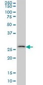 Monoclonal Anti-CA7 antibody produced in mouse clone 3B7, purified immunoglobulin, buffered aqueous solution