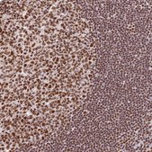 Anti-SBNO1 antibody produced in rabbit Prestige Antibodies&#174; Powered by Atlas Antibodies, affinity isolated antibody, buffered aqueous glycerol solution