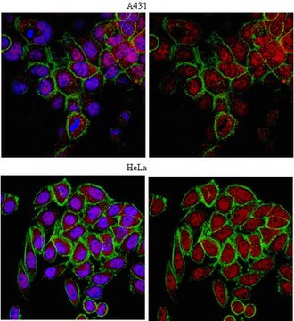 Anti-ERR-alpha P2 Antibody from rabbit