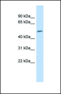 Anti-SOX11 antibody produced in rabbit affinity isolated antibody