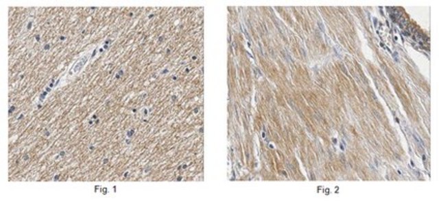 Anti-TRPM4 Antibody from rabbit, purified by affinity chromatography