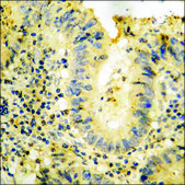 Anti-phospho-PYK2 (pTyr881) antibody produced in rabbit affinity isolated antibody