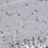 Anti-RRP1B antibody produced in rabbit Prestige Antibodies&#174; Powered by Atlas Antibodies, affinity isolated antibody, buffered aqueous glycerol solution, Ab2