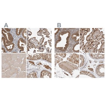 Anti-KYAT3 antibody produced in rabbit Prestige Antibodies&#174; Powered by Atlas Antibodies, affinity isolated antibody, buffered aqueous glycerol solution, Ab2