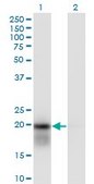 Monoclonal Anti-UBE2H antibody produced in mouse clone 3C4-1A2, purified immunoglobulin, buffered aqueous solution