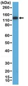 Anti-MSH3 Rabbit Monoclonal Antibody clone RM405, affinity purified immunoglobulin