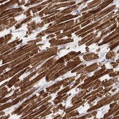 Monoclonal Anti-MYH6 antibody produced in mouse Prestige Antibodies&#174; Powered by Atlas Antibodies, clone CL2148, purified immunoglobulin, buffered aqueous glycerol solution