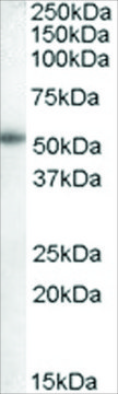 Anti-Aromatase/CYP19A1 antibody produced in goat affinity isolated antibody, buffered aqueous solution