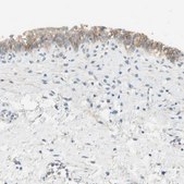 Anti-NECTIN4 antibody produced in rabbit Prestige Antibodies&#174; Powered by Atlas Antibodies, affinity isolated antibody, buffered aqueous glycerol solution