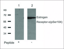Anti-phospho-ESR1 (pSer104) antibody produced in rabbit affinity isolated antibody