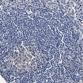 Anti-SLCO2B1 antibody produced in rabbit Prestige Antibodies&#174; Powered by Atlas Antibodies, affinity isolated antibody, buffered aqueous glycerol solution