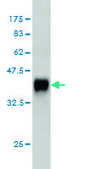 Monoclonal Anti-CACNB2 antibody produced in mouse clone 6C4, purified immunoglobulin, buffered aqueous solution