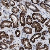 Anti-ATP1B1 antibody produced in rabbit Prestige Antibodies&#174; Powered by Atlas Antibodies, affinity isolated antibody, buffered aqueous glycerol solution