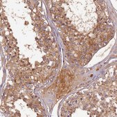 Anti-SOD3 antibody produced in rabbit Prestige Antibodies&#174; Powered by Atlas Antibodies, affinity isolated antibody, buffered aqueous glycerol solution