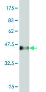 ANTI-SMAD4 antibody produced in mouse clone 2G4, purified immunoglobulin, buffered aqueous solution