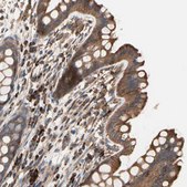 Anti-ROCK1 antibody produced in rabbit Prestige Antibodies&#174; Powered by Atlas Antibodies, affinity isolated antibody, buffered aqueous glycerol solution