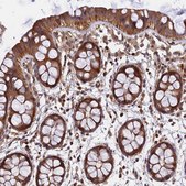 Anti-WDR41 antibody produced in rabbit Prestige Antibodies&#174; Powered by Atlas Antibodies, affinity isolated antibody, buffered aqueous glycerol solution