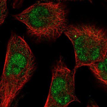 Anti-SGK1 antibody produced in rabbit Prestige Antibodies&#174; Powered by Atlas Antibodies, affinity isolated antibody