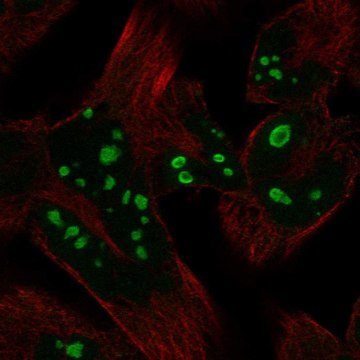 Anti-HERPUD2 antibody produced in rabbit Prestige Antibodies&#174; Powered by Atlas Antibodies, affinity isolated antibody
