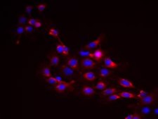 MOC2 Mouse Oral Squamous Cell Carcinoma (OSCC) Cell Line