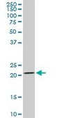 Monoclonal Anti-DHFR antibody produced in mouse clone 2B10, purified immunoglobulin, buffered aqueous solution