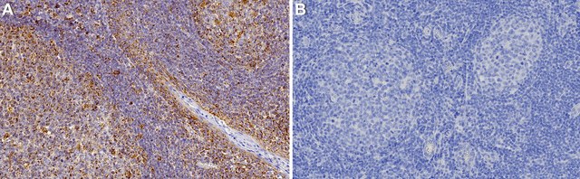 Anti-CD86 Antibody, clone 2H2 ZooMAb&#174; Rabbit Monoclonal recombinant, expressed in HEK 293 cells