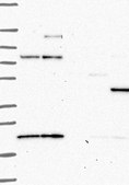 Anti-PRKAR2B antibody produced in rabbit Prestige Antibodies&#174; Powered by Atlas Antibodies, affinity isolated antibody, buffered aqueous glycerol solution