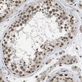 Anti-KAT5 antibody produced in rabbit Prestige Antibodies&#174; Powered by Atlas Antibodies, affinity isolated antibody, buffered aqueous glycerol solution