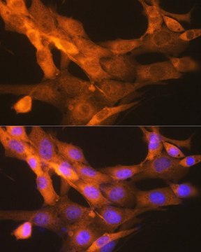 Anti-tPA/PLAT antibody produced in rabbit