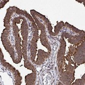 Anti-FMR1 antibody produced in rabbit Prestige Antibodies&#174; Powered by Atlas Antibodies, affinity isolated antibody, buffered aqueous glycerol solution