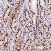 Anti-GALNT7 antibody produced in rabbit Prestige Antibodies&#174; Powered by Atlas Antibodies, affinity isolated antibody, buffered aqueous glycerol solution