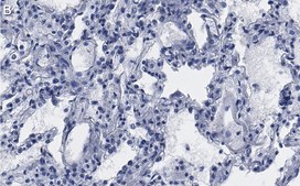 Anti-CD54 Antibody, clone 2C15 ZooMAb&#174; Rabbit Monoclonal recombinant, expressed in HEK 293 cells