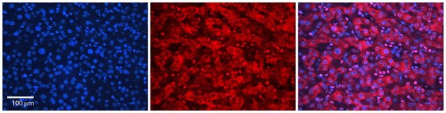 Anti-SLC26A3 antibody produced in rabbit affinity isolated antibody