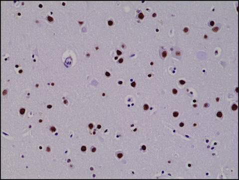 Anti-5-Hydroxymethylcytosine antibody, Rabbit monoclonal recombinant, expressed in HEK 293 cells, clone RM236, purified immunoglobulin