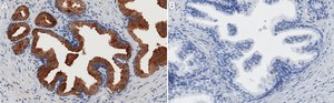 Anti-TIMP-1 Antibody, clone 1H19 ZooMAb&#174; Rabbit Monoclonal recombinant, expressed in HEK 293 cells