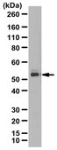 Anti-MATE2/SLC47A2 Antibody from rabbit, purified by affinity chromatography