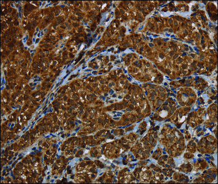 Anti-HSD17B13 antibody produced in rabbit affinity isolated antibody