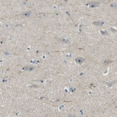 Anti-RRP1 antibody produced in rabbit Prestige Antibodies&#174; Powered by Atlas Antibodies, affinity isolated antibody, buffered aqueous glycerol solution, Ab2