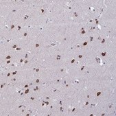 Anti-HN1 antibody produced in rabbit Prestige Antibodies&#174; Powered by Atlas Antibodies, affinity isolated antibody, buffered aqueous glycerol solution