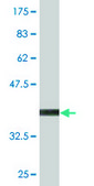 Monoclonal Anti-DPYSL5 antibody produced in mouse clone 2G4, purified immunoglobulin, buffered aqueous solution